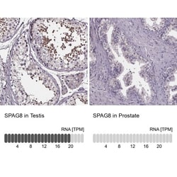 SPAG8 Antibody, Novus Biologicals 0.1mL; Unlabeled:Antibodies, Polyclonal